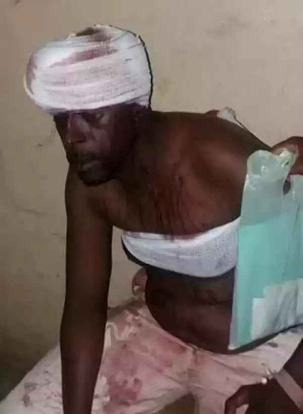 See What Area Boys Did To This Kannywood Actor In Kano (Graphic Photos)